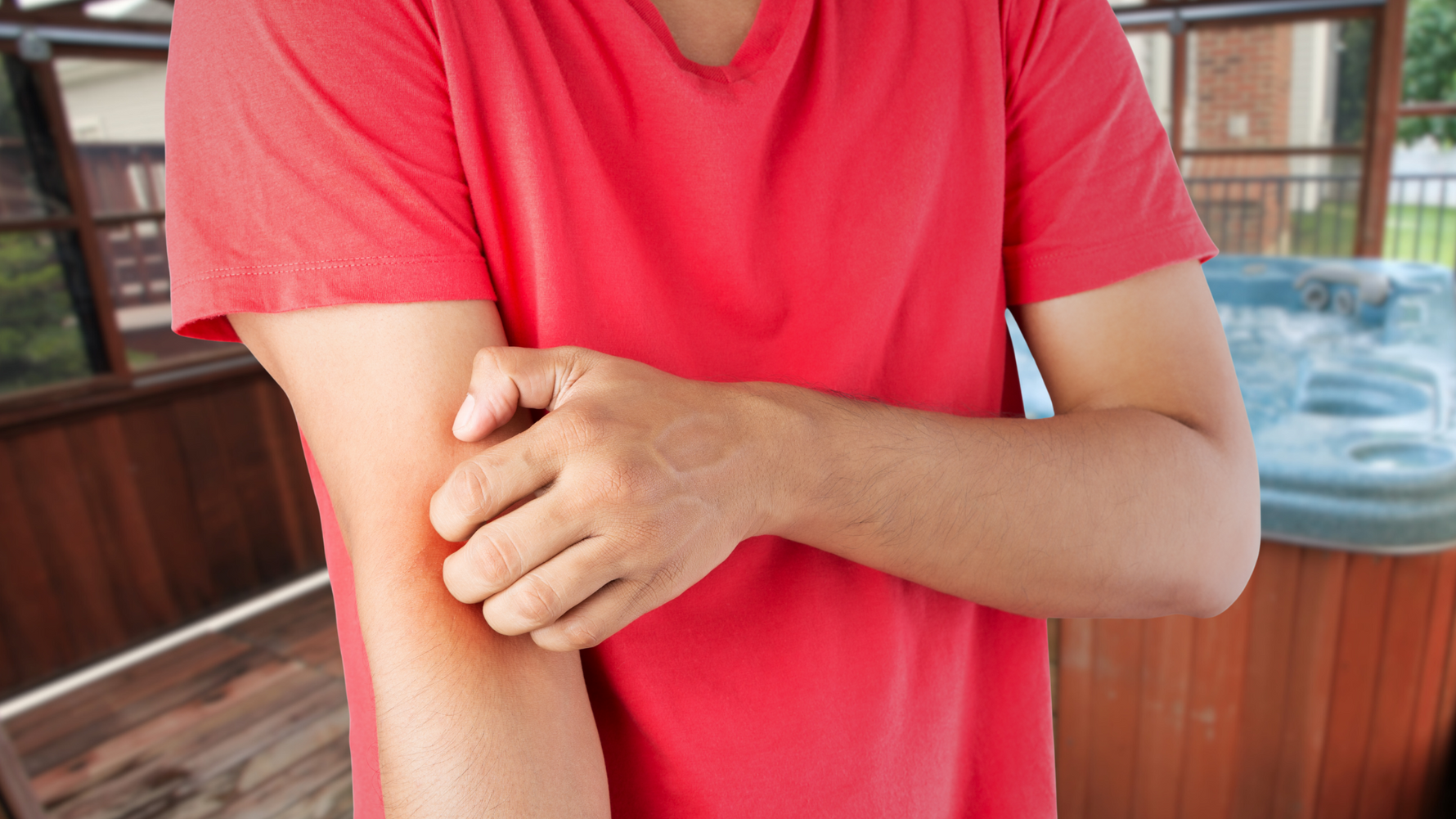 What Is Hot Tub Rash? (Hot Tub Folliculitis) And How To Prevent It