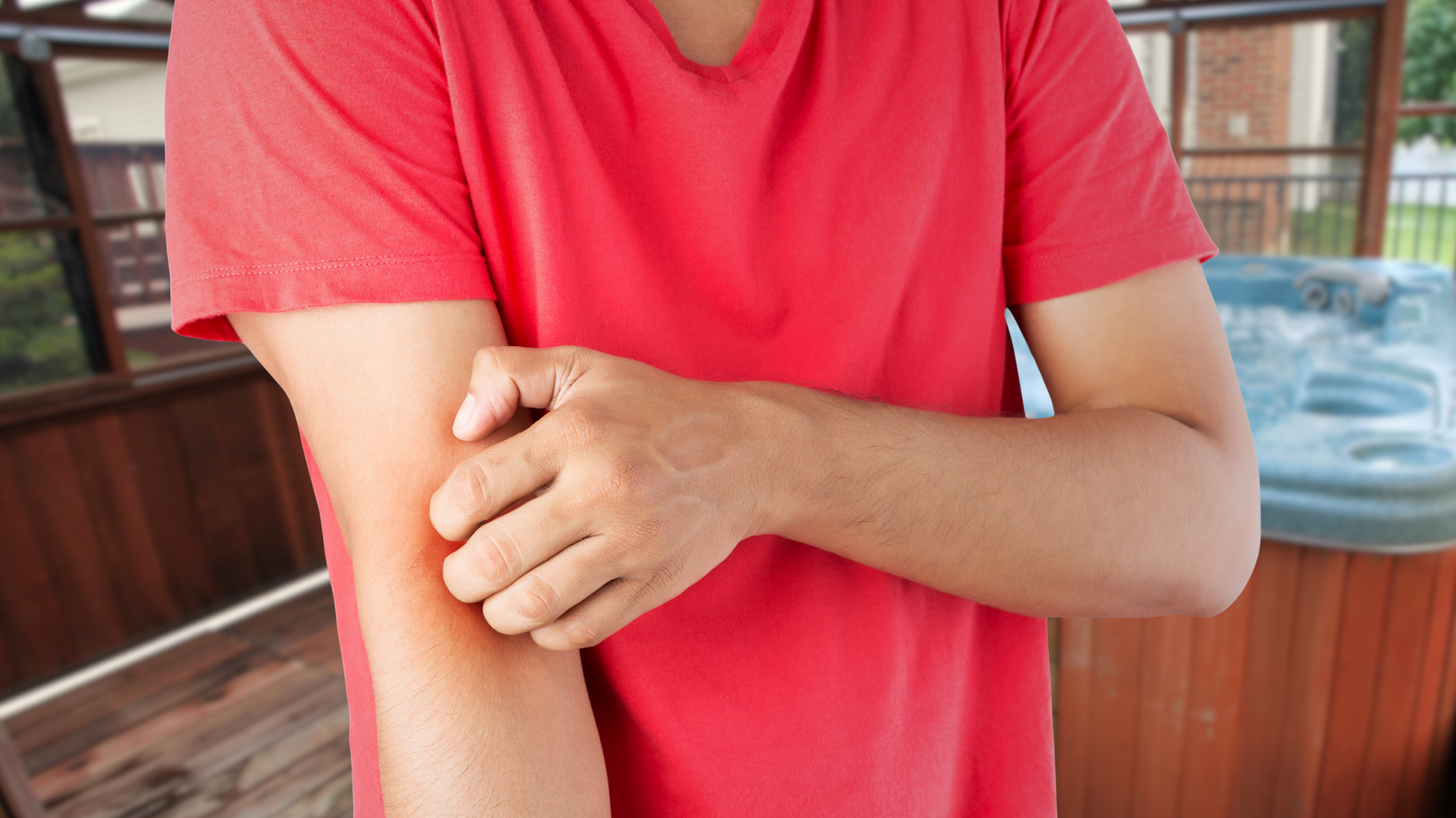 What Is Hot Tub Rash? (Hot Tub Folliculitis) And How To Prevent It ...